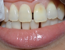 Chan Dental teeth before