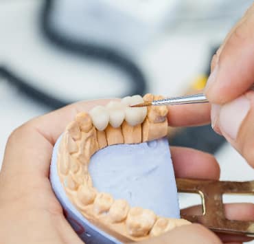 Chan Dental CROWNS